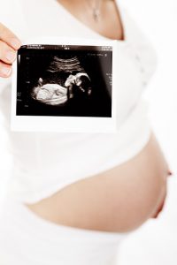 אבחון תסמונות לפני הלידה: איך מאבחנים והאם אבחון לקוי הוא רשלנות רפואית?
