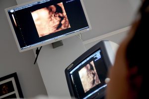 אבחון תסמונות לפני הלידה: איך מאבחנים והאם אבחון לקוי הוא רשלנות רפואית?