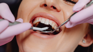 רשלנות רפואית בהשתלת שיניים